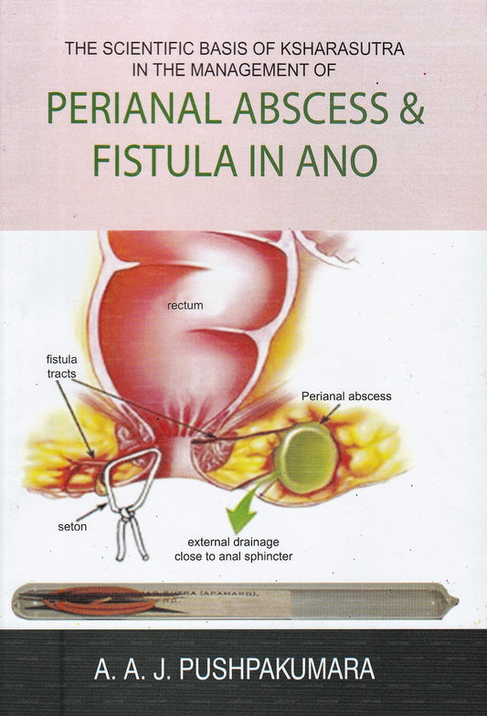 Die wissenschaftliche Grundlage von Ksharasutra bei der Behandlung von Perianalabszessen und -abszessen. Fistel in Ano 